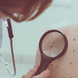 Doctor inspecting skin marks with magnifying tool 
