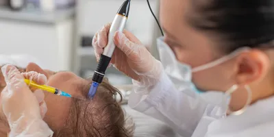 Trichologist cosmetologist doctor applies syringe injections on head scalp for hair loss treatment. 