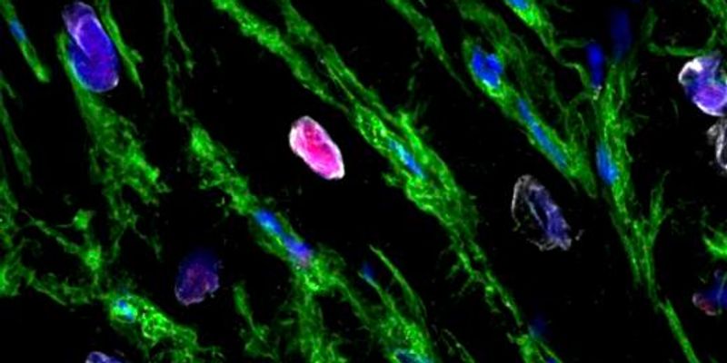 Photograph accompanying Human heart muscle cells divide after a heart attack in tissue taken during bypass surgery