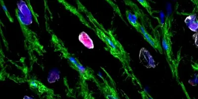 Pink areas in image shows heart muscle cells replicating. 