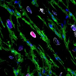 Pink areas in image shows heart muscle cells replicating. 