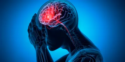 Man with brain stroke