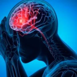 Man with brain stroke