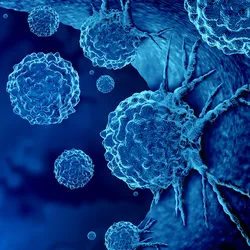 Malignant cancer cells are shown as a blue cluster of cells is against a dark blue background.   