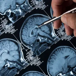 MRI Brain Scan of head and skull 