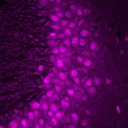 Fluorescent microscopy image showing a dense cluster of rounded cells stained in bright magenta against a darker purple background. The cells appear tightly packed, with visible nuclei and subtle variation in size and shape, forming a distinct band or layer within surrounding tissue.