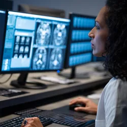 Side view of female radiologist looking at the MRI image of the head on her monitor and analyzing it.