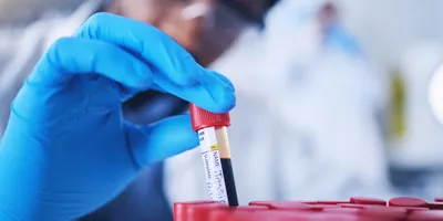 A male scientist lifts a test tube filled with blood from a rack in the lab.