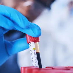 A male scientist lifts a test tube filled with blood from a rack in the lab.