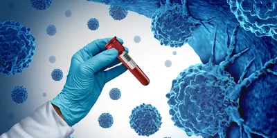 A gloved hand holding a blood test amidst cancer cells. 