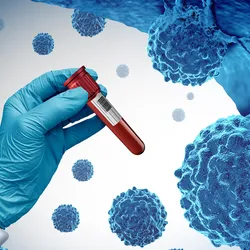 A gloved hand holding a blood test amidst cancer cells. 
