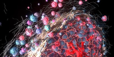 Illustration of a tumor microenvironment showing cancer cells surrounded by immune cells and extracellular structures, highlighting complex cellular interactions.