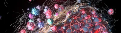 Illustration of a tumor microenvironment showing cancer cells surrounded by immune cells and extracellular structures, highlighting complex cellular interactions.
