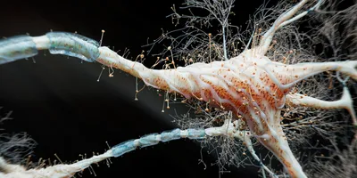 New initiative expands access to sporadic ALS stem cell models | Drug  Discovery News