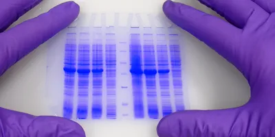 Hands wearing protective gloves hold blue-stained electrophoresis gel with separated proteins.