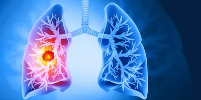 Rendered image of lungs against blue background