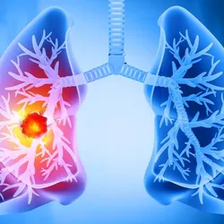 Rendered image of lungs against blue background 