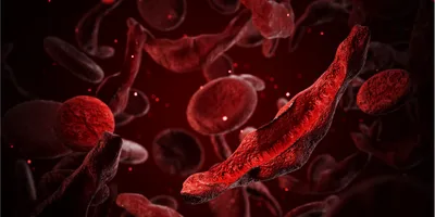 Blood flow with both normal and sickled blood cells.