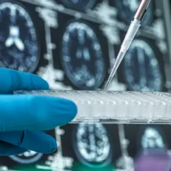 Scientist dispensing liquid into a multi-well plate in a laboratory setting, in front of brain scans. 