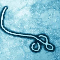A blue-colored microscopic image of the Ebola virus.