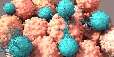 3D illustration of engineered immune cells interacting with tumor cells.