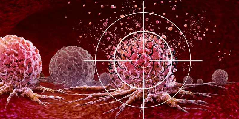 Ultrasound Cancer Treatment and new Cancer killing tumours therapy with vibrating molecules breaking the membranes of malignant tumor cells as an oncology therapy fighting Cancerous Growth and Metastasis.