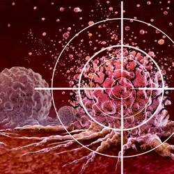 Ultrasound Cancer Treatment and new Cancer killing tumours therapy with vibrating molecules breaking the membranes of malignant tumor cells as an oncology therapy fighting Cancerous Growth and Metastasis.