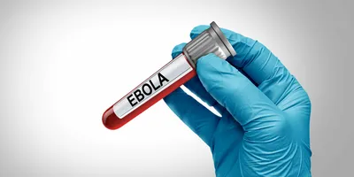 A photo of a gloved blue hand holding a vial of blood labelled Ebola.