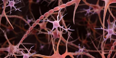 A black background with pink microglia brain cells.