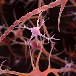 A black background with pink microglia brain cells.
