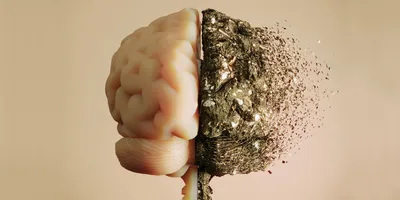 A 3D image of a human brain with one side appearing healthy and the other side disintegrating.