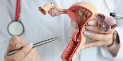 The doctor's hands hold a sectional model of the female reproductive organs.