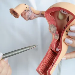 The doctor's hands hold a sectional model of the female reproductive organs.