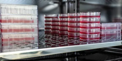 Cell culture Petri dishes inside an incubator