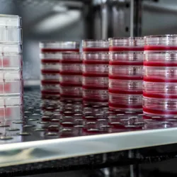 Cell culture Petri dishes inside an incubator