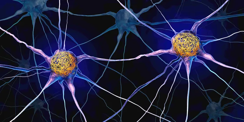 A neuron with a yellow cell body and purplish-colored axons on a black background