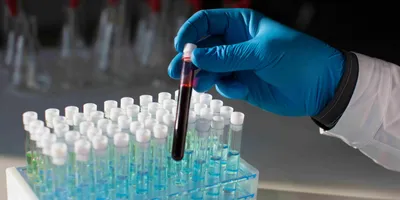 A photo of a gloved hand holding a vial of blood