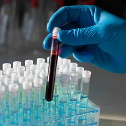 A photo of a gloved hand holding a vial of blood