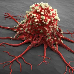 A 3D medical illustration of a cancer cell or tumor, featuring a main red mass covered in bumpy white textures with long, root-like tentacles branching outward across a gray surface.