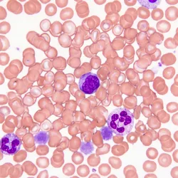 Close-up of blood cells highlighting B cells for therapy.