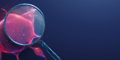 Digital illustration of a magnifying glass enlarging a red tumor composed of clustered cells. 