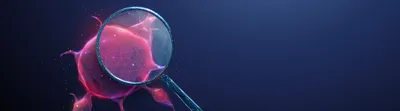 Digital illustration of a magnifying glass enlarging a red tumor composed of clustered cells. 