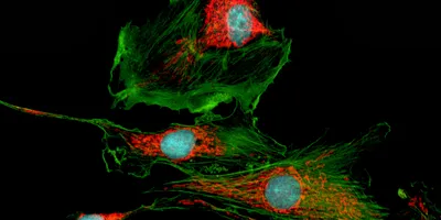 Fluorescent image of several cells with green filamentous structures, red intracellular staining, and blue nuclei against a black background.