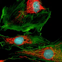 Fluorescent image of several cells with green filamentous structures, red intracellular staining, and blue nuclei against a black background.