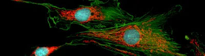 Fluorescent image of several cells with green filamentous structures, red intracellular staining, and blue nuclei against a black background.