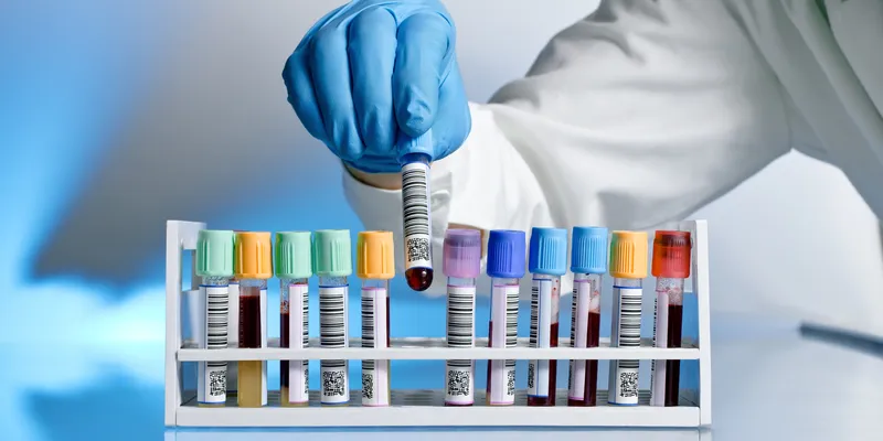 A gloved laboratory technician selects a labeled blood sample tube from a rack containing multiple color-coded collection tubes.