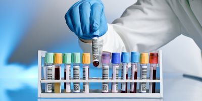 A gloved laboratory technician selects a labeled blood sample tube from a rack containing multiple color-coded collection tubes.