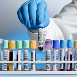 A gloved laboratory technician selects a labeled blood sample tube from a rack containing multiple color-coded collection tubes.