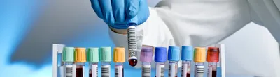 A gloved laboratory technician selects a labeled blood sample tube from a rack containing multiple color-coded collection tubes.A gloved laboratory technician selects a labeled blood sample tube from a rack containing multiple color-coded collection tubes.