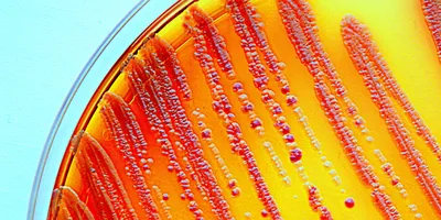 Bacteria grown on a selective agar plate.